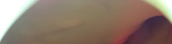 Gas Tank Fuel Petrol 2006 Triumph Sprint ST ABS 1445 x